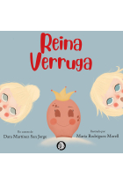 Reina Verruga