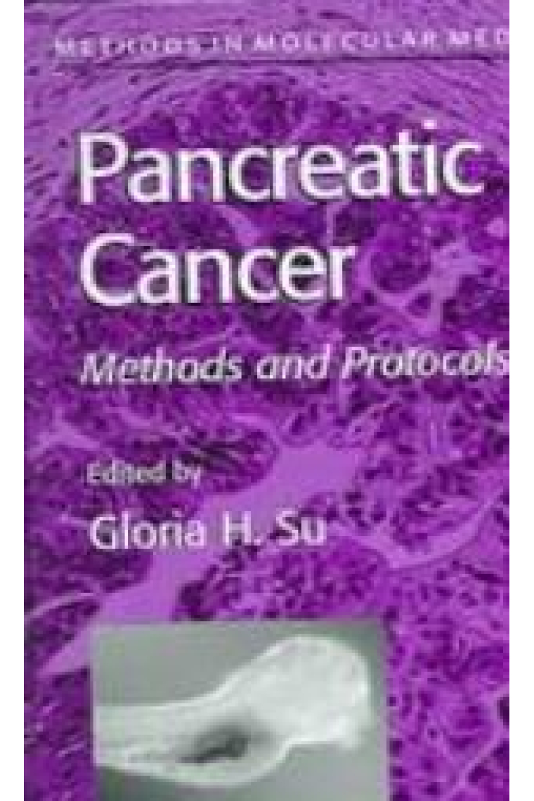 Pancreatic Cancer