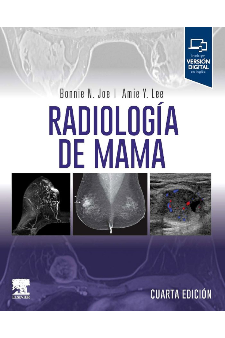 RADIOLOGIA DE MAMA 4ª ED