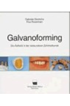 Galvanoforming