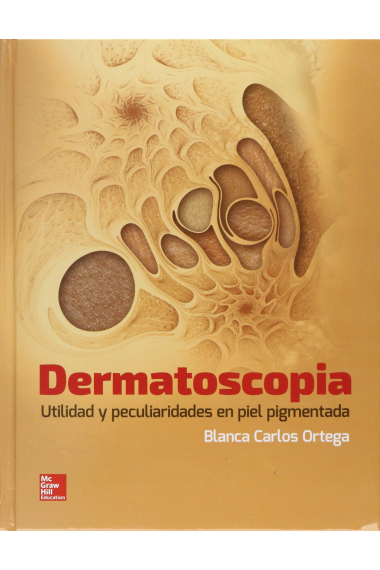 Dermatoscopia. Utilidad y peculiaridades en piel pigmentada