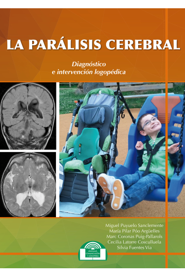 La Parálisis Cerebral. Diagnóstico e Intervención Logopédica