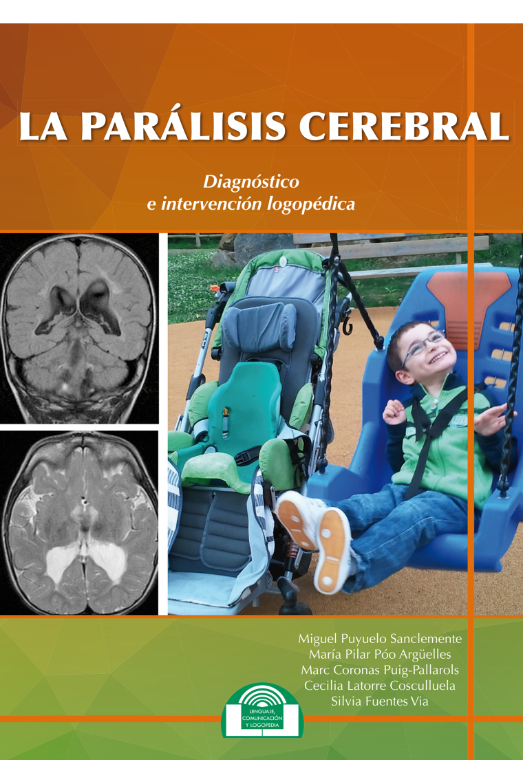 La Parálisis Cerebral. Diagnóstico e Intervención Logopédica