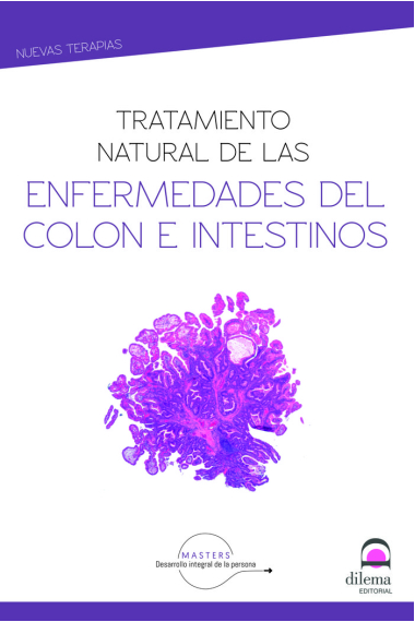 Tratamiento natural de enfermedades del colon e intestinos