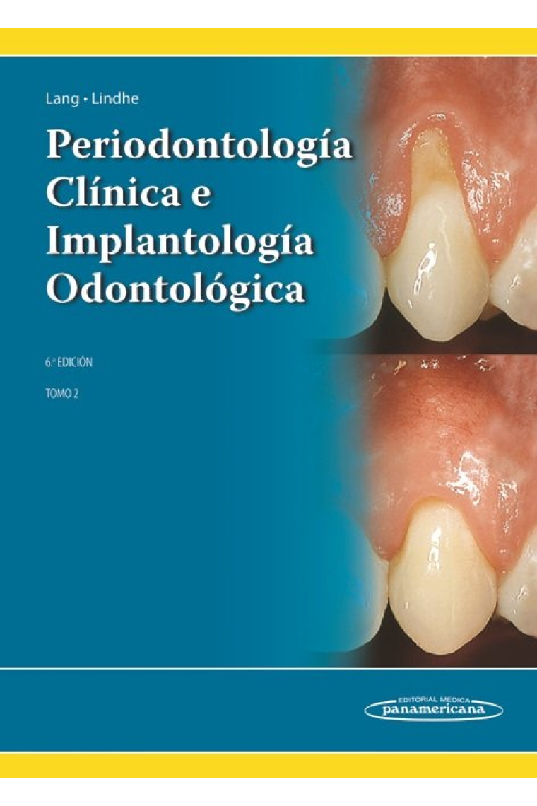 LINDHE:PeriodontologÆa ClÆnica 6a Ed. T2