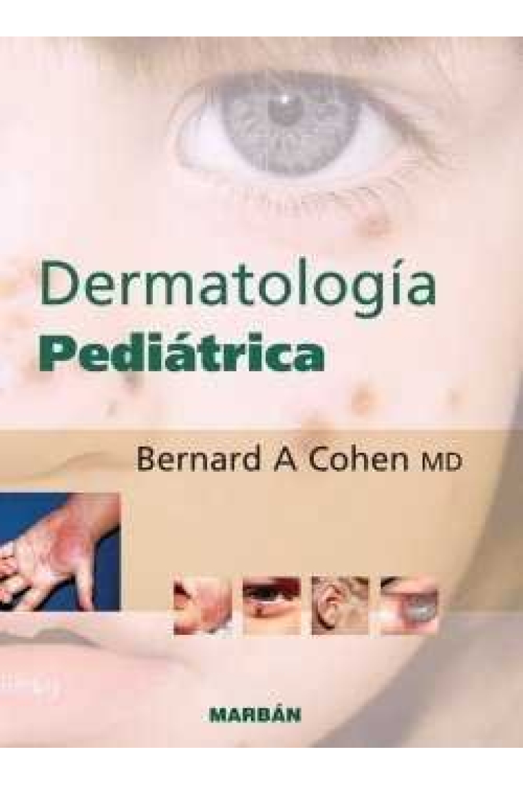 DERMATOLOGIA PEDIATRICA