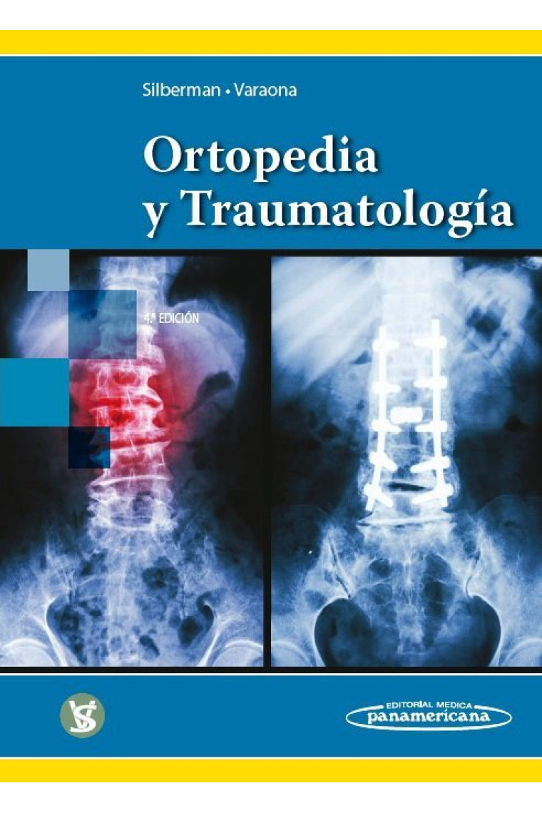 SILBERMAN:Ortopedia y TraumatologÆa 4aEd