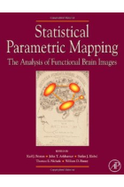 Statistical Parametric Mapping: The Analysis of Functional Brain Images