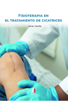 FISIOTERAPIA EN EL TRATAMIENTO DE CICATRICES