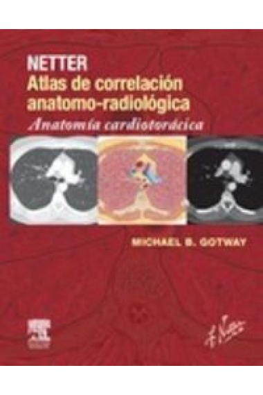 Netter. Atlas de correlación anatomo-radiológica: Anatomía cardiotorácica