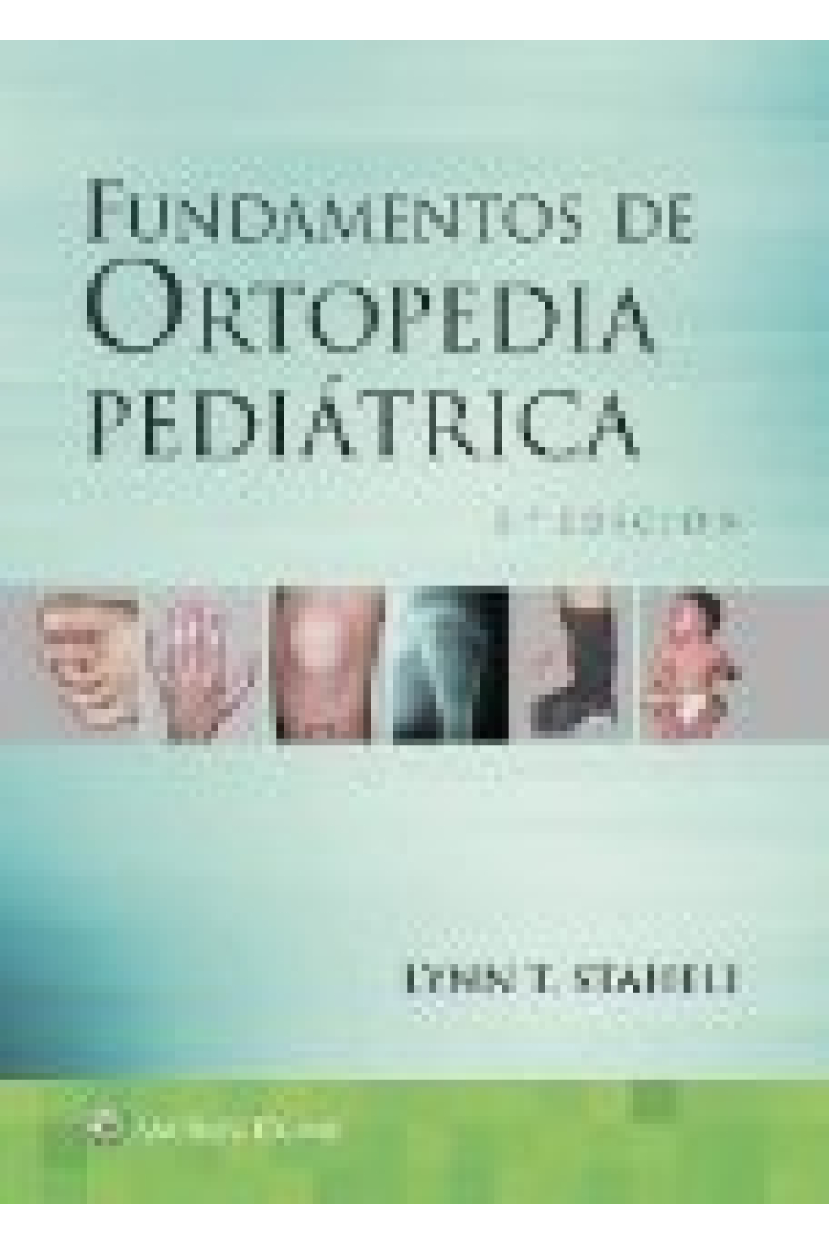 FUNDAMENTOS DE ORTOPEDIA PEDIATRICA