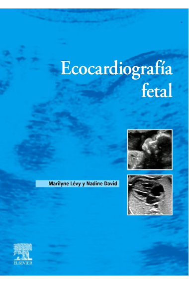 ECOCARDIOGRAFIA FETAL