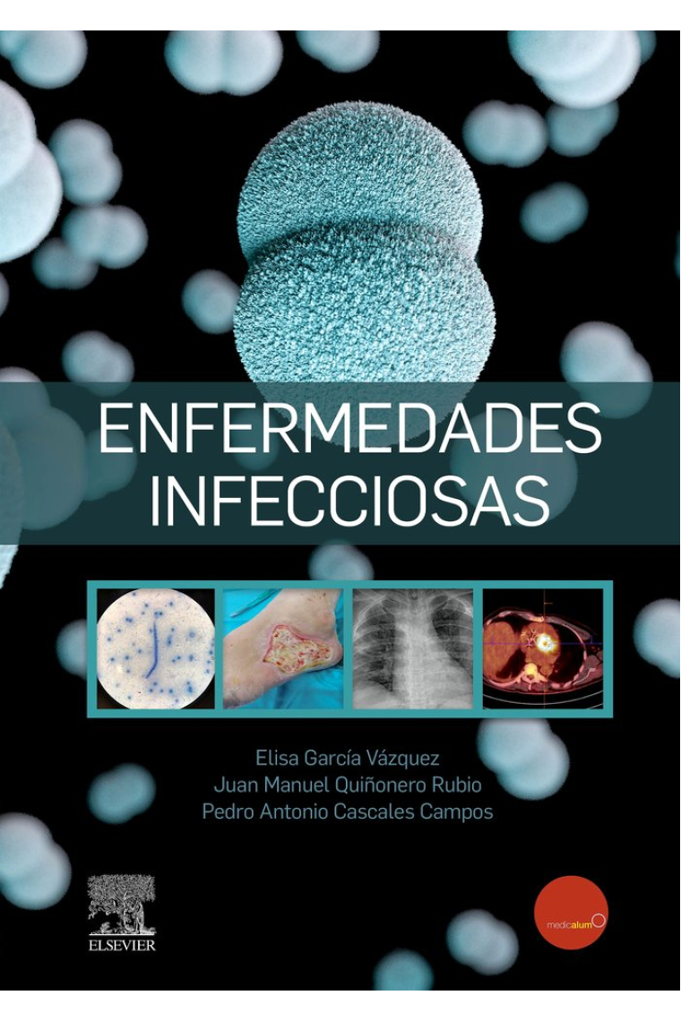 ENFERMEDADES INFECCIOSAS