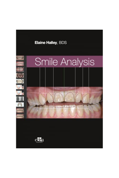 SMILE ANALYSIS