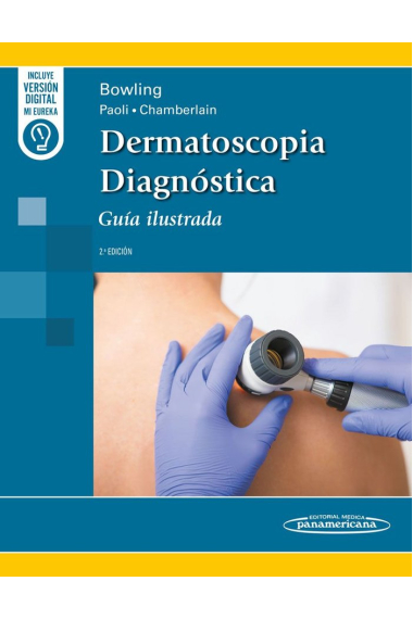 DERMATOSCOPIA DIAGNOSTICA