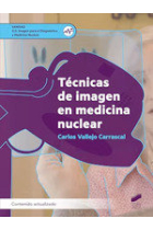 TECNICAS DE IMAGEN EN MEDICINA NUCLEAR CFGS