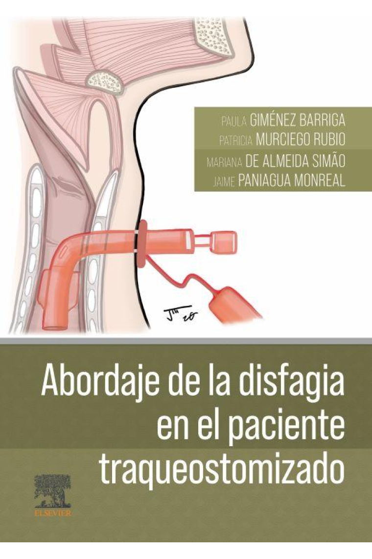 Abordaje de la disfagia en el paciente traqueostomizado