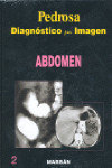 DIAGNOSTICO POR IMAGEN VOL. II ABDOMEN