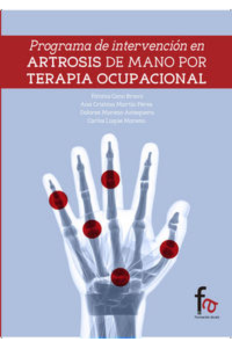 PROGRAMA DE INTERVENCION EN ARTROSIS DE MANOS POR TERAPIA OCUPACIONAL