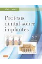 Prótesis dental sobre implantes (2ª ed.)