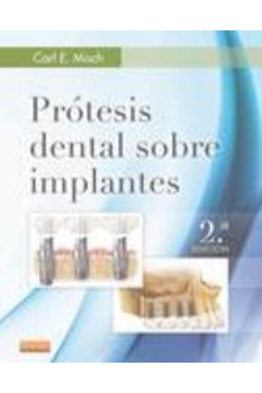 Prótesis dental sobre implantes (2ª ed.)