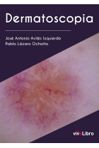 Dermatoscopia