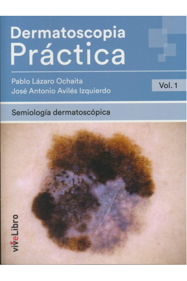 Dermatoscopia Práctica. Vol. 1: Semiología Dermatoscópica