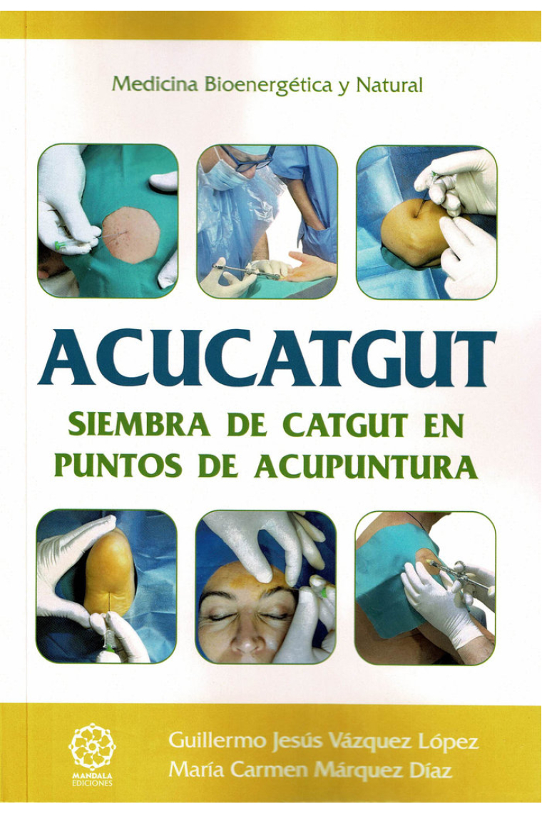 ACUCATGUT SIEMBRA DE CATGUT EN PUNTOS DE ACUPUNTURA