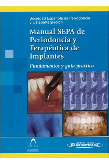 SEPA:Manual Periodoncia y Osteointegr.