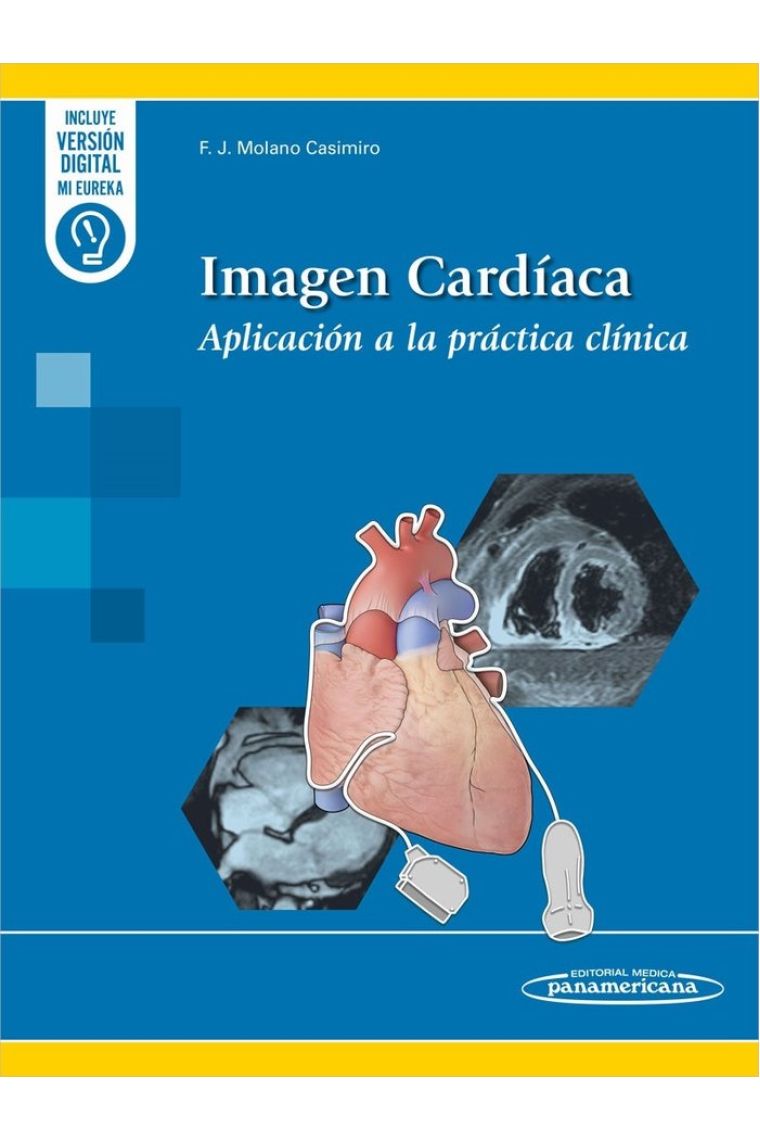 IMAGEN CARDIACA