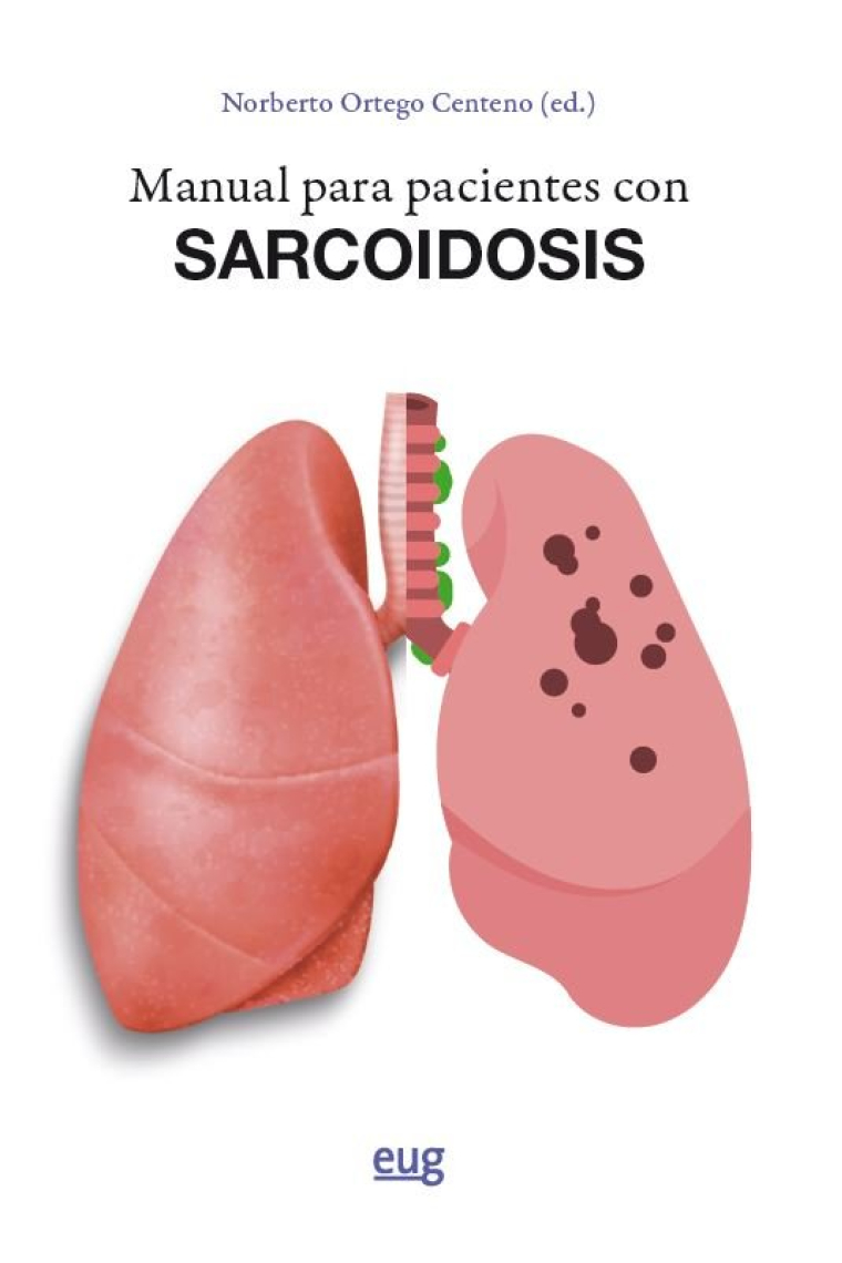 MANUAL PARA PACIENTES CON SARCOIDOSIS