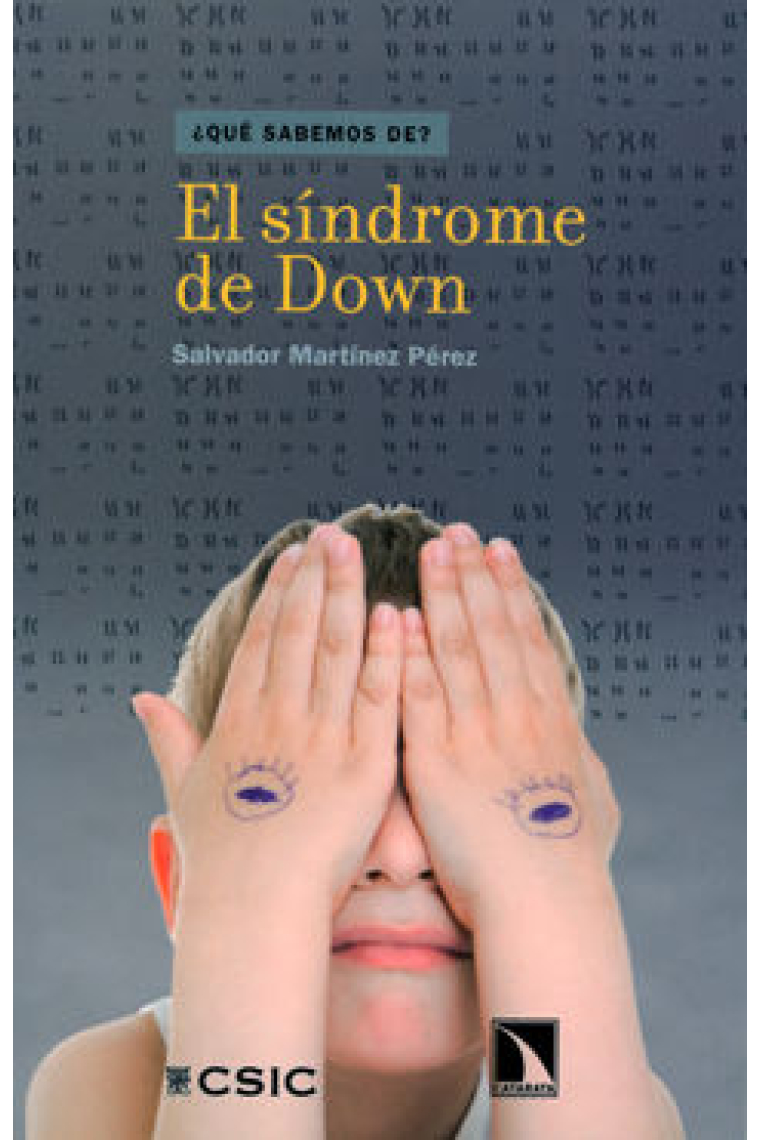 SINDROME DE DOWN,EL