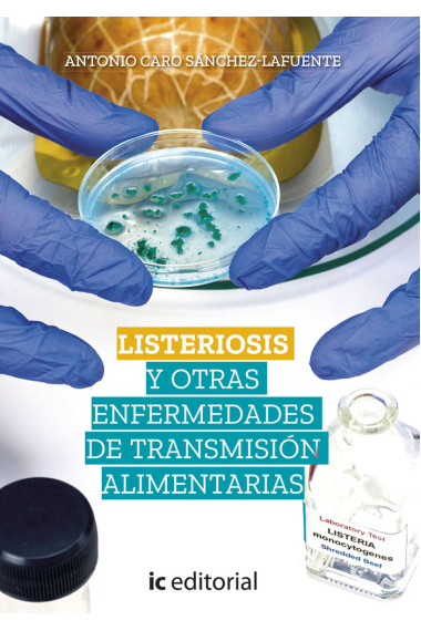 LISTERIOSIS Y OTRAS ENFERMEDADES DE TRANSMISION ALIMENTARIAS