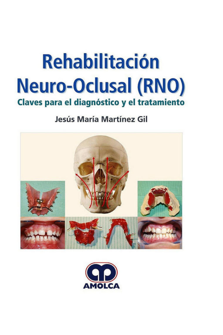 REHABILITACION NEURO-OCLUSAL (RNO) CLAVES PARA EL DIAGNOSTICO Y EL TRATAMIENTO