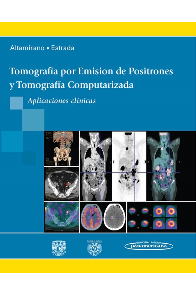 ALTAMIRANO:Tomograf. Emision Positron.TC