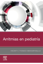 ARRITMIAS EN PEDIATRIA