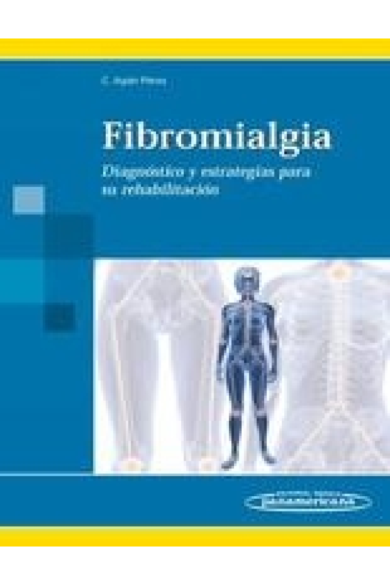 Fibromialgia. Diagnóstico y estrategias para su rehabilitación