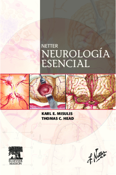 Neurología esencial