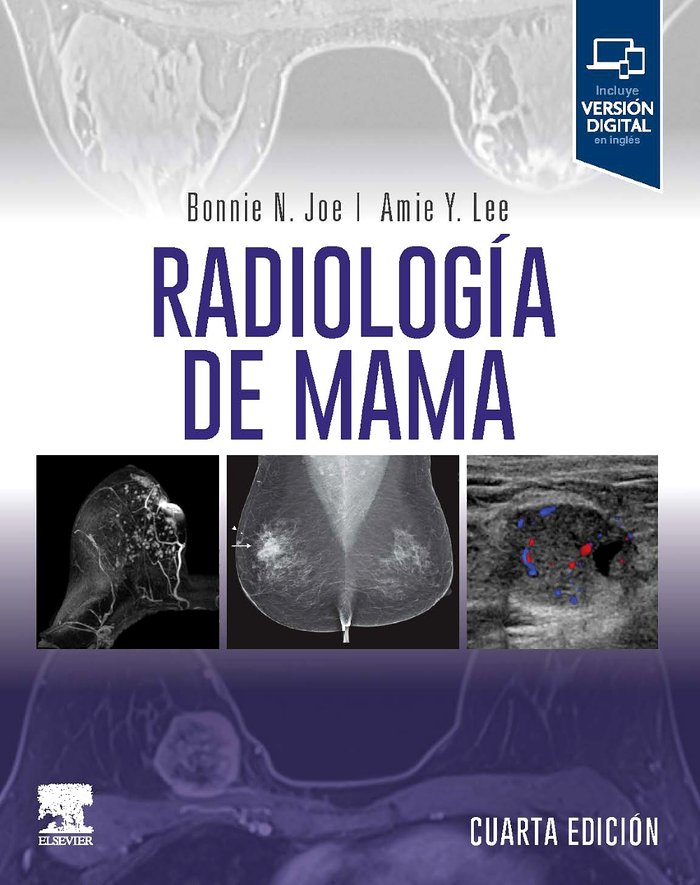 RADIOLOGIA DE MAMA 4ª ED