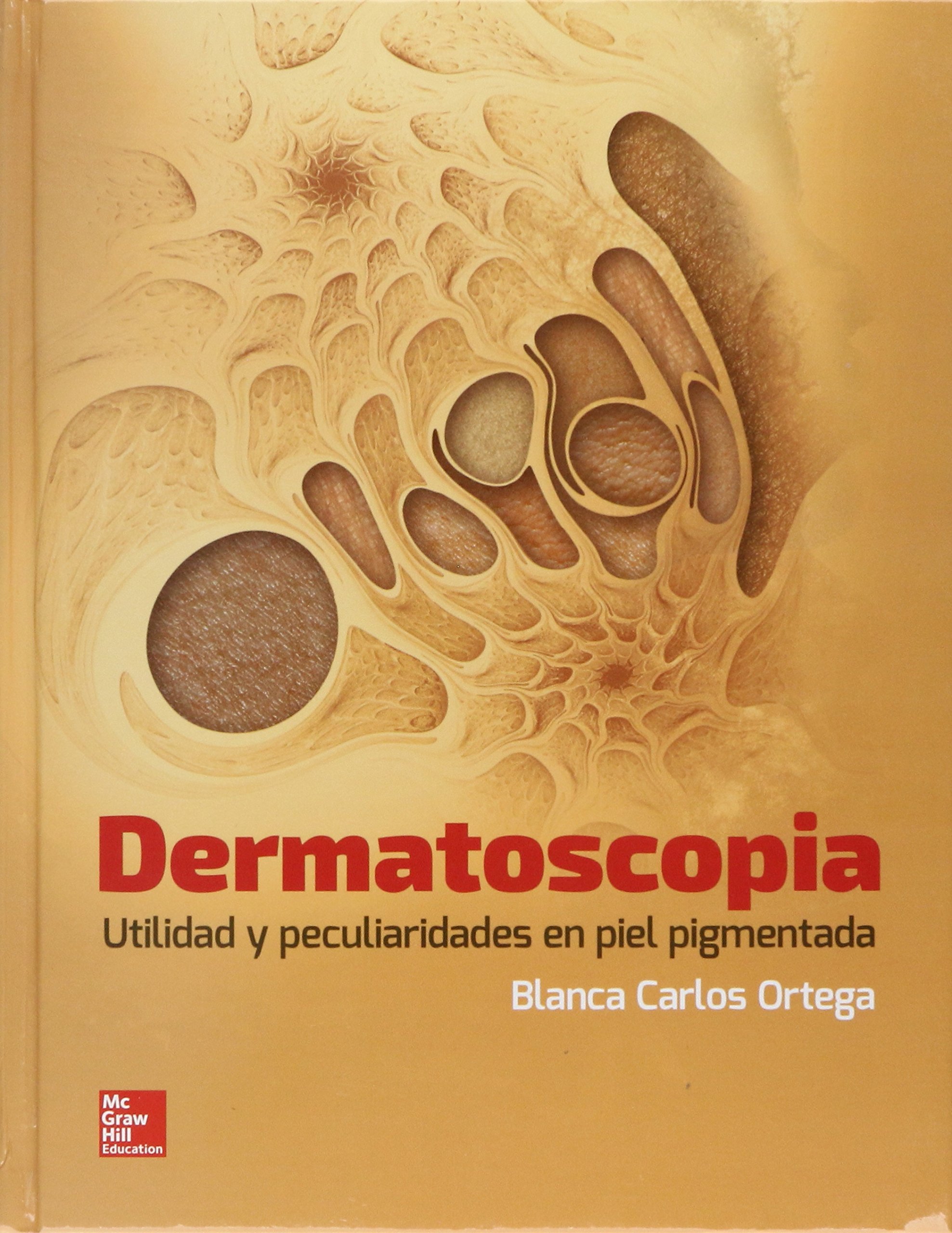 Dermatoscopia. Utilidad y peculiaridades en piel pigmentada