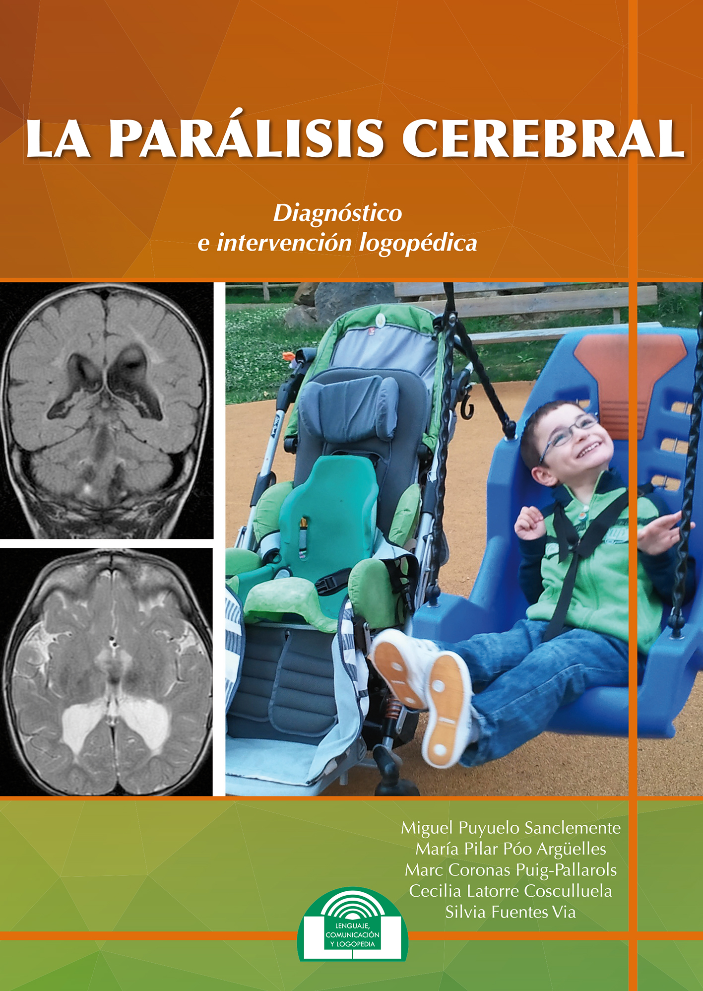 La Parálisis Cerebral. Diagnóstico e Intervención Logopédica