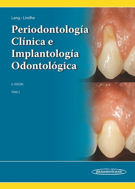 LINDHE:PeriodontologÆa ClÆnica 6a Ed. T2