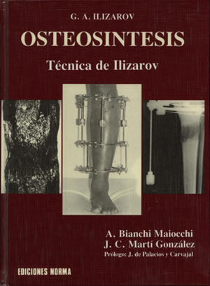 Osteosintesis