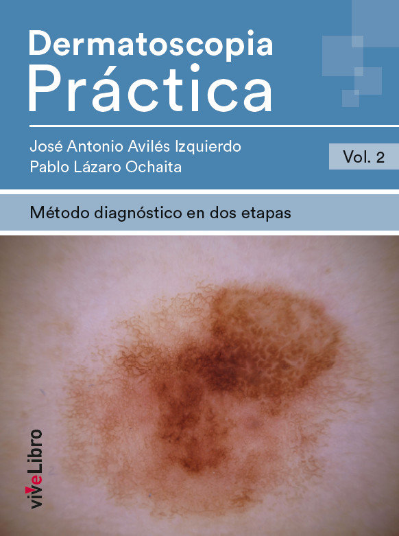 Dermatoscopia Práctica. Vol. 2: Método diagnóstico en dos etapas