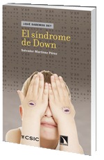 El sindrome de Down