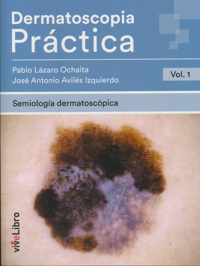 Dermatoscopia Práctica. Vol. 1: Semiología Dermatoscópica