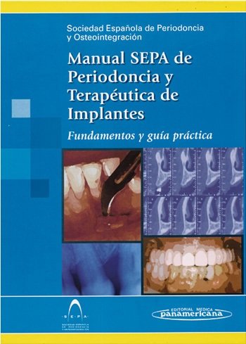 SEPA:Manual Periodoncia y Osteointegr.